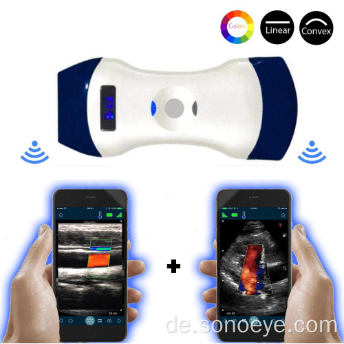 OEM Wifi Convex &amp; Linear Color Ultraschallsonde